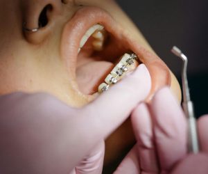 pexels-photo-6528908-6528908 Dentist examining patient's braces during a dental appointment.